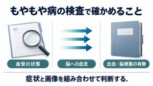 もやもや病の検査で確かめることを整理した図。