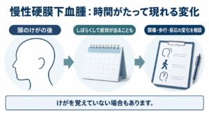 慢性硬膜下血腫：時間がたって現れる変化を整理した図。